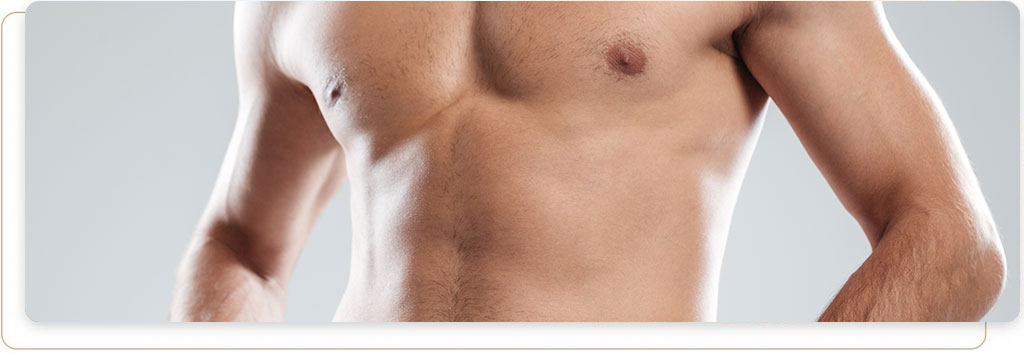 Gynecomastia
